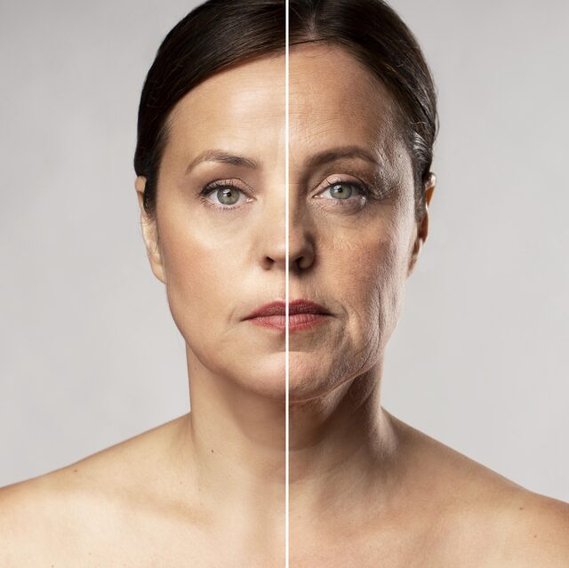 Sculptra