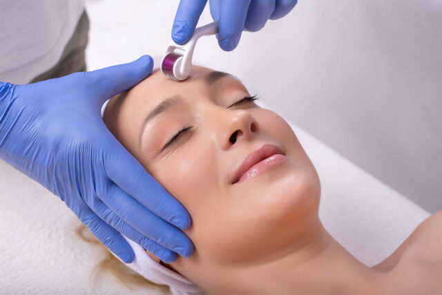 Microneedling